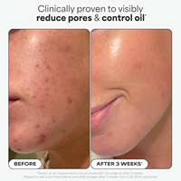 Sérum Exfoliant Liquide à 2% d'Acide Salicylique BHA Marque Blanche, Contrôle du Sébum, Désobstrue les Pores, Améliore les Points Noirs, Sérum Facial OEM ODM