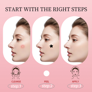 Patchs anti-acné bicolores en forme d'étoile |   Points de soin hydrocolloïdes noirs et blancs pour les boutons |   Couvre-imperfections invisible approuvé CE pour le visage - Product Image 3