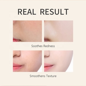 Personnalisation OEM Soins <span class=keywords><strong>de</strong></span> la peau coréens Essence du visage élimine les <span class=keywords><strong>taches</strong></span> <span class=keywords><strong>brunes</strong></span> et éclaircit le teint 10% Nicotinamide 4% Acide tranexamique - Product Image 3