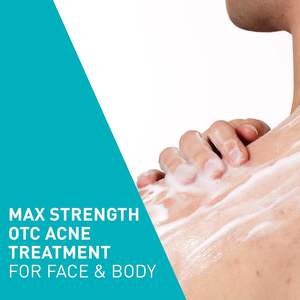 Crème Nettoyante Moussante Anti-Acné en Gros 10% Peroxyde de Benzoyle Nettoyant Doux Visage et Corps avec Acide Hyaluronique et Niacinamide - Product Image 1