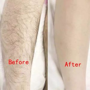 Épilateur de peau soyeuse pour les bras, les jambes, le corps, méthode purement physique, épilateur sans douleur, épilation en cristal à domicile - Product Image 6