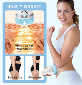 Nuovi Arrivi 2026 Massaggiatore Anticellulite per Pancia, Vita e Gambe, Dispositivo Portatile per Tonificazione e Sollevamento Glutei - Product Image 3