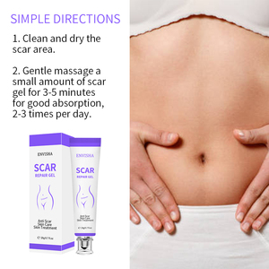 <span class=keywords><strong>Crema</strong></span> de eliminación de cicatrices de belleza, Gel, estrías, <span class=keywords><strong>quemaduras</strong></span>, reparación quirúrgica de cicatrices, <span class=keywords><strong>crema</strong></span> blanqueadora suavizante - Product Image 2