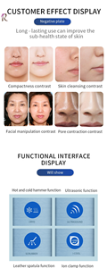 Dispositivo Multifunzionale per la Cura della Pelle di Ottimo Rapporto Qualità-Prezzo con Terapia Facciale Non Invasiva per Skincare Domestica, Pronto per la Spedizione - Product Image 2