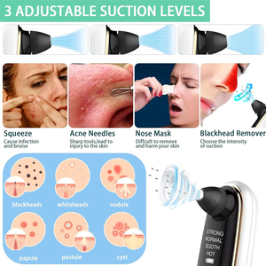 <span class=keywords><strong>Appareil</strong></span> d'aspiration visuelle des points noirs, <span class=keywords><strong>appareil</strong></span> de nettoyage des <span class=keywords><strong>pores</strong></span> <span class=keywords><strong>du</strong></span> <span class=keywords><strong>visage</strong></span>, <span class=keywords><strong>appareil</strong></span> électrique portable <span class=keywords><strong>pour</strong></span> l'élimination des points noirs et des micro-bulles - Product Image 3