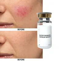 Neues Hautpflege serum Facial 4 in 1 White ning Anti Age Gesichts serum mit 30% Vitamin C 5% Niacin amid 10% Vitamin E Serum