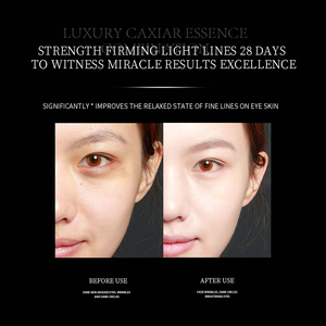 Crème pour les yeux anti-rides QUANXIN OEM/ODM, collagène raffermissant, crème de <span class=keywords><strong>nuit</strong></span> brillante pour resserrer les yeux - Product Image 2