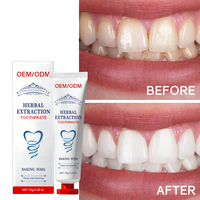 Dentifrice OEM Doux pour l'Hygiène Buccale, Blanchissant, Élimine les Taches, Combat la Mauvaise Haleine, Anti-Caries