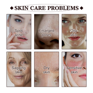 <span class=keywords><strong>Maschera</strong></span> Viso al Tè Nero per la Pulizia dei Pori e il Controllo dell'Olio, Effetto Lifting e Rassodante, Prodotti per la Cura della Pelle a Marchio Privato - Product Image 3