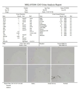 Analyseur de sédiments d'<span class=keywords><strong>urine</strong></span> entièrement automatisé/analyseur d'<span class=keywords><strong>urine</strong></span> 120 T/H Machine d'analyse d'<span class=keywords><strong>urine</strong></span> - Product Image 6