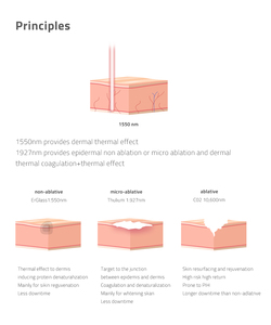1550nm erbium Kính <span class=keywords><strong>Laser</strong></span> da tái tạo bề mặt fractional 1550nm erbium Kính <span class=keywords><strong>laser</strong></span> không xâm lấn mụn sẹo erbium Kính <span class=keywords><strong>Laser</strong></span> - Product Image 3