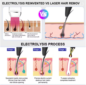 Appareil professionnel d'épilation permanente par électrolyse, sans douleur, pour le visage et le corps - Product Image 2