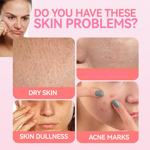 Nuova Crema Schiarente per il Viso Sakura, Nutriente, Sbiancante, Coprente per l'Acne, Idratante, Uniformante il Tono della Pelle - Product Image 2