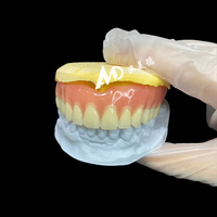 Prothèse Dentaire Complète d'Aspect Naturel - Prothèse Totale Premium pour Patients Édéntés