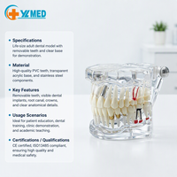 Modèle pédagogique dentaire du nerf pellucide médical, détachable, pour l'étude pathologique, CE/ISO
