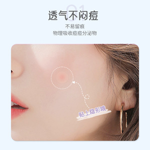 Parche para el acné Yuezi, transpirable, ligero e impermeable, adecuado para lesiones de la piel, abrasiones y heridas. Venta al por mayor de fábrica. - Product Image 3