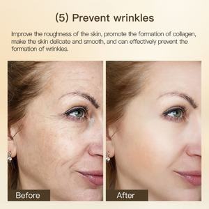 Venta Directa de Fábrica, Suero Facial Antienvejecimiento y Blanqueador, Suero de Niacinamida Antienvejecimiento, Suero Facial con Vitamina C - Product Image 6