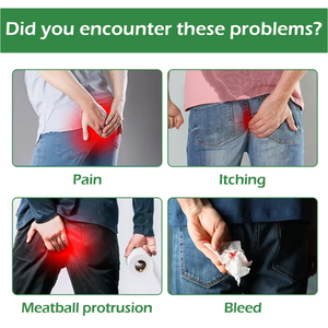 ครีม<span class=keywords><strong>ทา</strong></span>แก้ริดสีดวงทวาร สูตรเร่งด่วน แก้รอยแยกทวารหนัก ครีม<span class=keywords><strong>ริดสีดวง</strong></span>ทวาร ครีม<span class=keywords><strong>ริดสีดวง</strong></span>ทวารของแท้  รับผลิตตามความต้องการ - Product Image 2