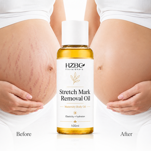 Huile de soin corporel en gros 100 ml pour l'élimination des vergetures de grossesse, des cicatrices et des vergetures, raffermissante et hydratante - Product Image 1