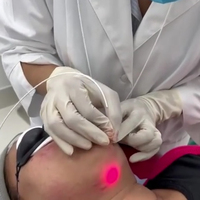 Machine de lipolyse et de liposuccion la plus efficace pour le remodelage corporel, laser diode 980nm 1470nm, Endolaserlift