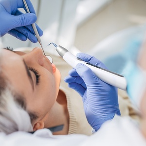 Prezzo a buon mercato Root Canal Sonic irrigatore dentale endodontico attivatore - Product Image 6