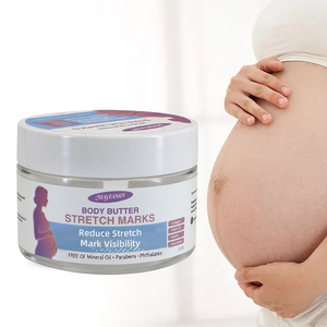 Beurre corporel anti-vergetures Mayfancy, réduit la visibilité des vergetures, soin de la peau pendant la grossesse, 120g - Product Image 1