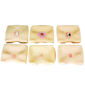 Staged Bedsore Nursing Model Drucks ch merzen Pflege Simulator mit Wunden - Product Image 2