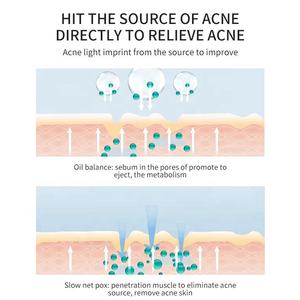 Crème <span class=keywords><strong>Anti</strong></span>-Acné Rapide et <span class=keywords><strong>Efficace</strong></span> à l'Arbre à Thé pour le Soin du <span class=keywords><strong>Visage</strong></span>, Réparation <span class=keywords><strong>Anti</strong></span>-Imperfections, Réduction des Pores, Cicatrices et Points Noirs - Product Image 5
