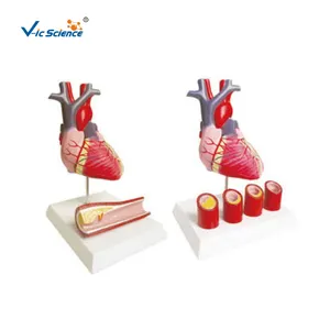 Модель сердца естественного размера, прикрепленная к пораженной артерии, модель анатомии сердца