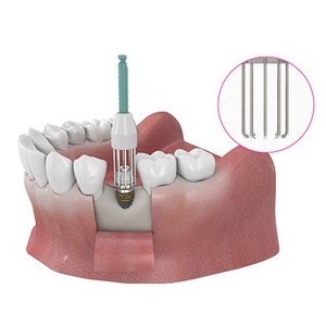Neobiotech R-Brush เครื่องมือทันตกรรมรากฟันเทียมแปรงไทเทเนียมกำจัดสิ่งปนเปื้อนบนพื้นผิวเครื่องมือทันตกรรมรากฟันเทียม - Product Image 5