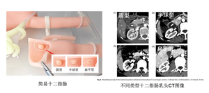 Mô hình đào tạo phẫu thuật dạ dày, phẫu thuật ercp, thực hành duodenoscope, vị trí dễ bị (không có đầu) - Product Image 4