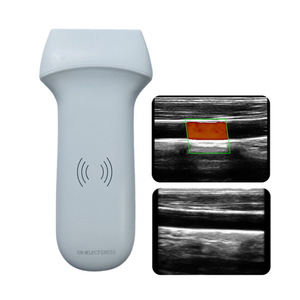 Escáner <span class=keywords><strong>de</strong></span> Ultrasonido Doppler Lineal Portátil Inalámbrico <span class=keywords><strong>de</strong></span> Alta Frecuencia CProbe-8L para Exámenes <span class=keywords><strong>de</strong></span> Piel, Vasos Sanguíneos y Senos - Product Image 4