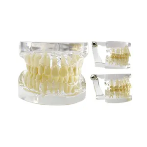 牙科用品牙科研究模型牙齿蓝色粉色透明牙科研究标准模型