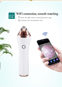Aspiratore Elettrico Visibile per Pori del Viso, Trattamento Acne, Rimozione Punti Neri con 3 Testine di Aspirazione - Product Image 6