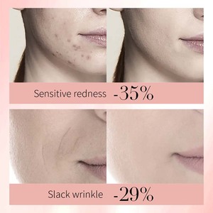 Ensemble de soins de beauté OEM ODM FAYANKOU à l'acide ferulique de rose, comprenant sérum, crème, nettoyant, lotion, crème pour les yeux, 8 produits, coffret cadeau - Product Image 3