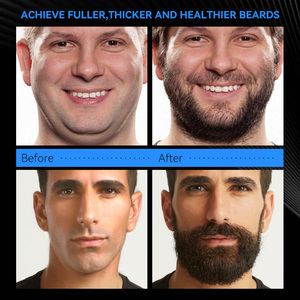 Kit de croissance de <span class=keywords><strong>barbe</strong></span> pour hommes ODM OEM, biotine, ensemble de croissance rapide de la <span class=keywords><strong>barbe</strong></span> naturelle, étiquette personnalisée, soin pour hommes, booster de moustache - Product Image 4