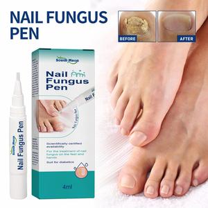 SOUTH MOON Venta al por mayor 5ML Herbal Nail Fungus Treatment Pen Anti Fungal Nail Foot Hongus Remove Gel Nail Repair Tratamiento líquido - Product Image 5