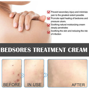 Crema para el Tratamiento de Úlceras por Presión EELHOE 20g, Alivia el Dolor, las Náuseas en las Piernas, Curación de Heridas Infecciosas, Elimina las Úlceras por Presión - Product Image 3