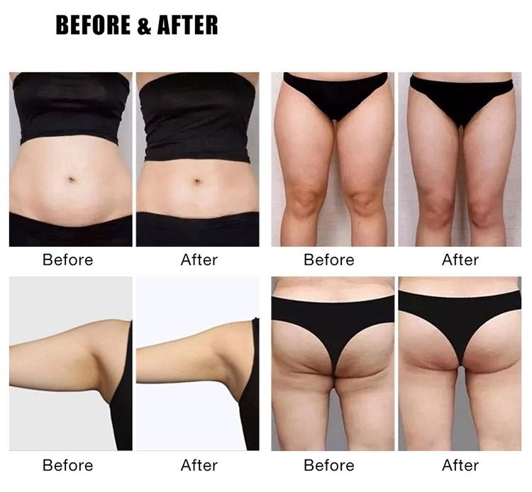 Rf 7 Tesla Ems Slimming Machine For Burn Fat