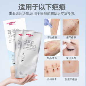 Apósito de gel de silicona Wellday 4cmx15cm para la prevención y el tratamiento de cicatrices - Product Image 3