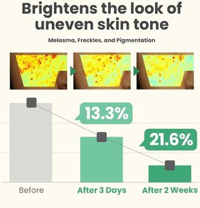 ETRUN ALISA Marque privée Crème à la niacinamide Correcteur des taches brunes pour les taches solaires Melasma Taches de rousseur Élimination des taches de vieillesse - Product Image 6