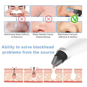 Aspirateur à tête noire, nettoyeur profond de pores, amovible esthétique, Machine pour retirer les points noirs - Product Image 3