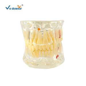 Modèle <span class=keywords><strong>dentaire</strong></span> scientifique médical avec dent manquante pour la formation dans les écoles et les hôpitaux - Vic Science - Product Image 1