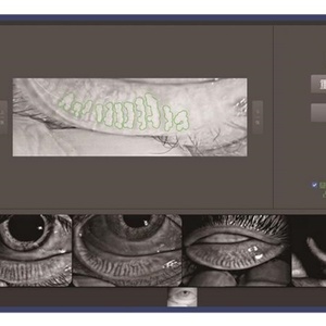 Testeur et détecteur complet et polyvalent pour l'analyse de la sécheresse oculaire tout-en-un, du lacrimal au gland, outil de diagnostic de la sécheresse oculaire DEA-800 - Product Image 6