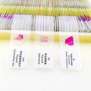 100個の人間の病気の病理学準備されたスライド準備された顕微鏡スライドを教える - Product Image 1