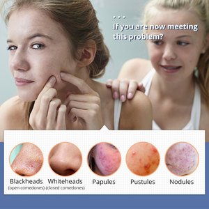 Nouvel appareil portable de rajeunissement et de raffermissement de la peau, traitement de l'acné, machine de maquillage permanent à eau oxygénée, portable, Royaume-Uni - Product Image 3