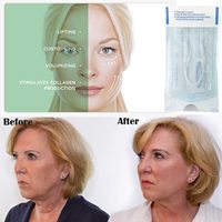Ligne de protéines de soie Radar sans aiguille Fils de collagène Vitamine C Tighten Lift Collagène infusé de vitamines en soie gravé en V Livraison gratuite