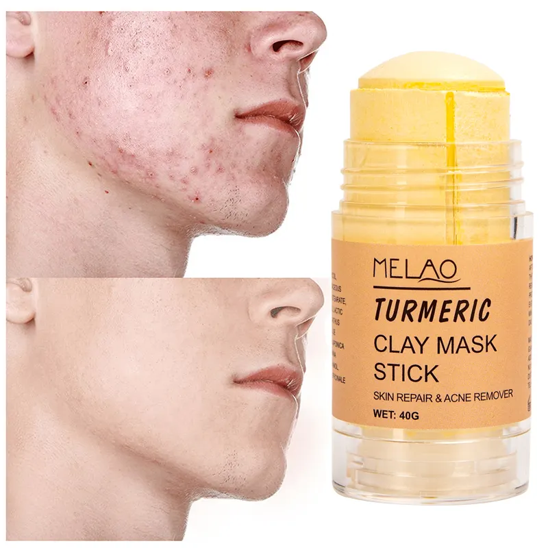 Private Label Effective Deep Clean Gently Exfoliate Pore Detox Mud Musk Turmeric Clay Mask Facial Mask Stick Turmeric