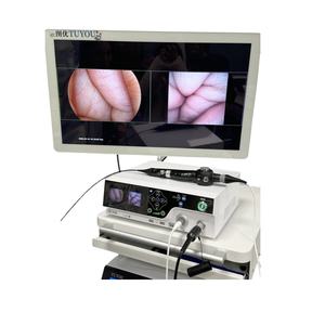 Tuyou sistem endoskopi medis portabel, kamera endoskopi kaku fleksibel <span class=keywords><strong>Unit</strong></span> pemeriksaan ultrasonik & Elektronik - Product Image 1