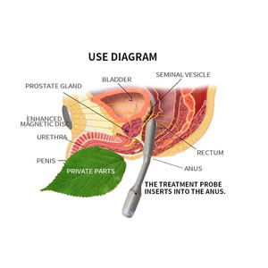 Dispositivo digital de terapia de próstata <span class=keywords><strong>para</strong></span> el <span class=keywords><strong>tratamiento</strong></span> de la prostatitis crónica C y La BPH - Product Image 3